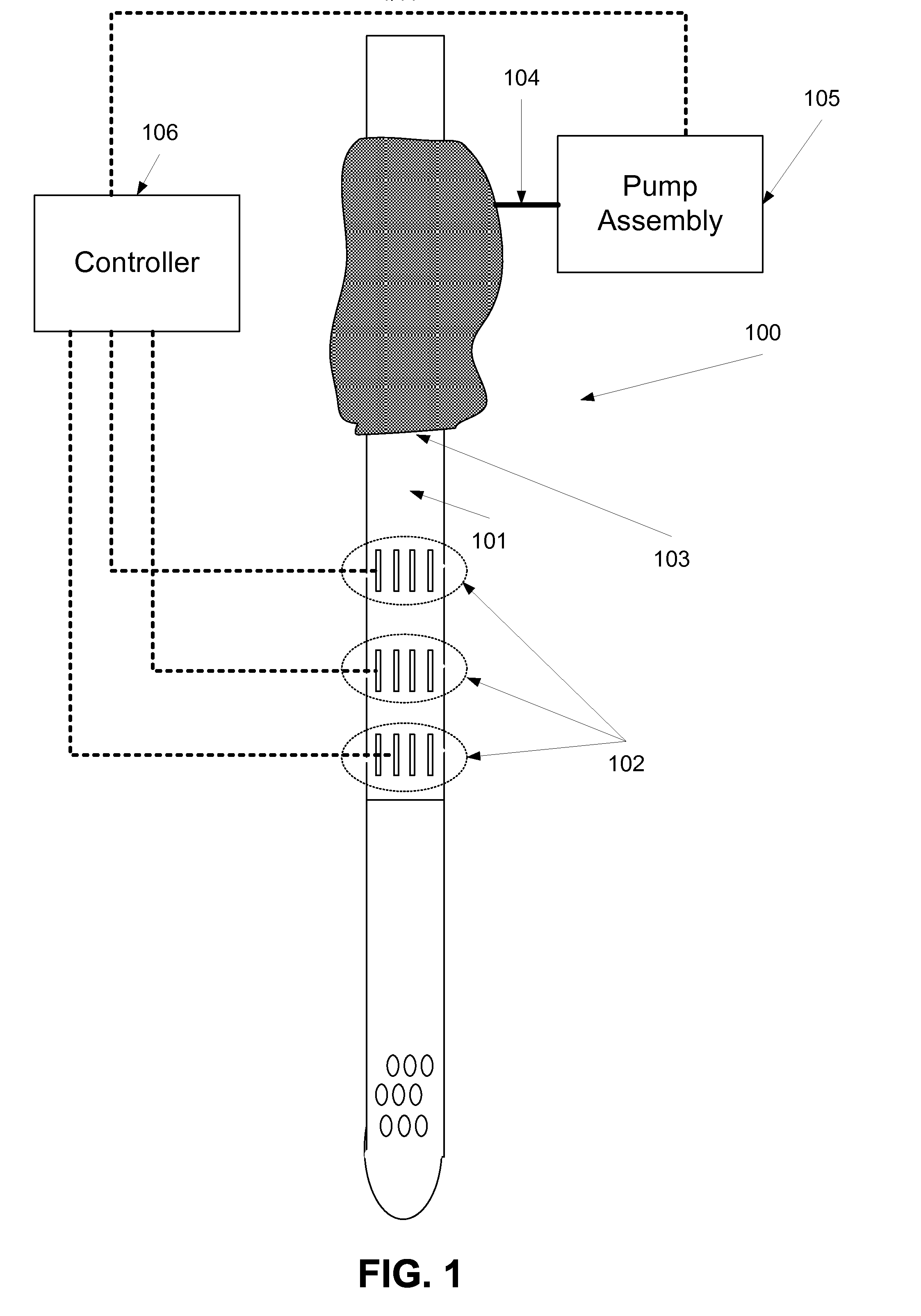 Method and device of detecting and/or blocking reflux
