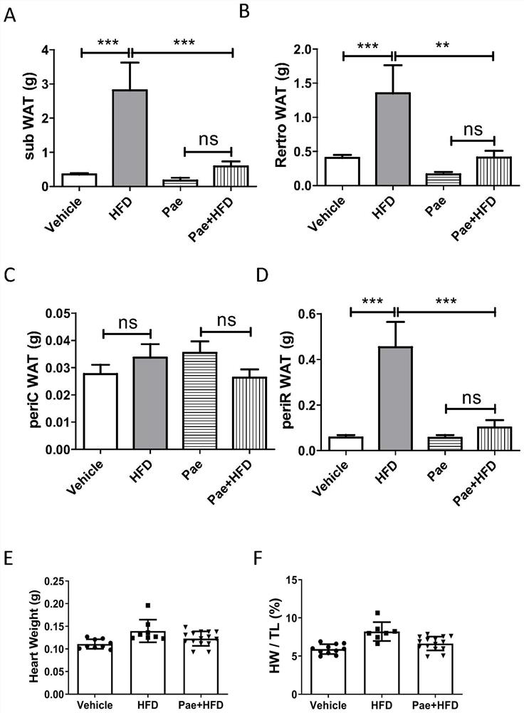 Application of paeonol in preparation of medicine for treating obesity and lipotoxic cardiomyopathy