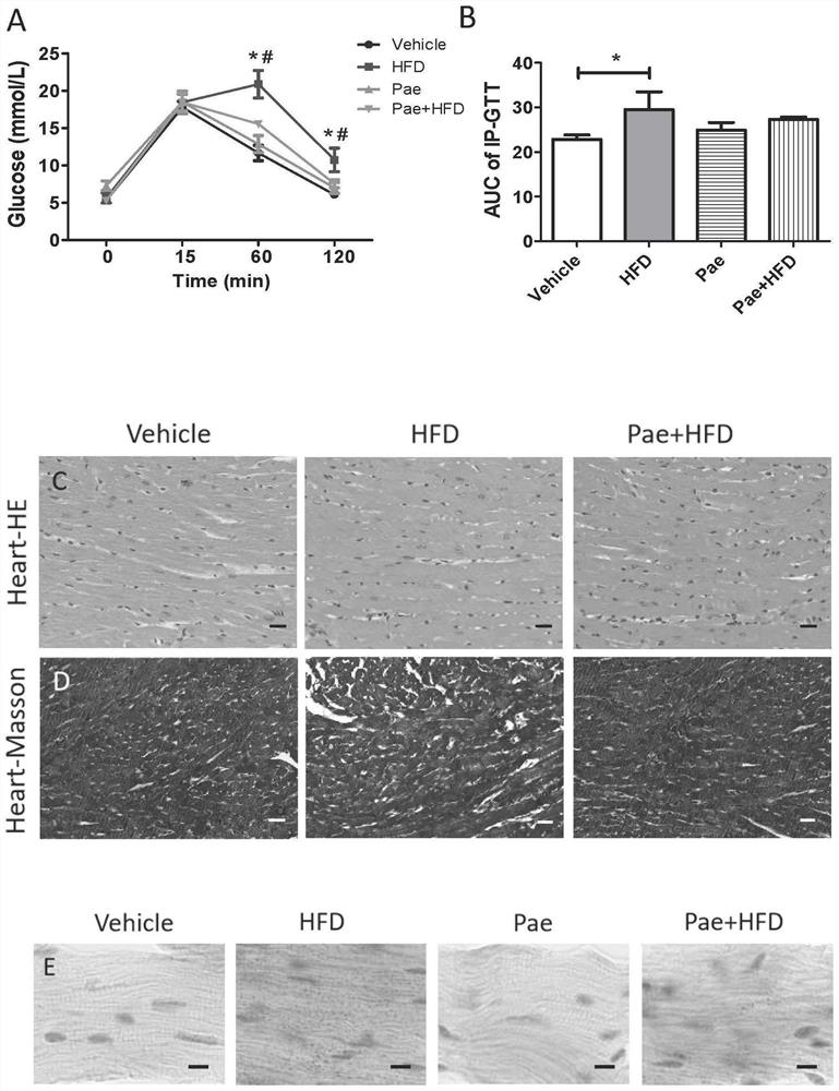 Application of paeonol in preparation of medicine for treating obesity and lipotoxic cardiomyopathy