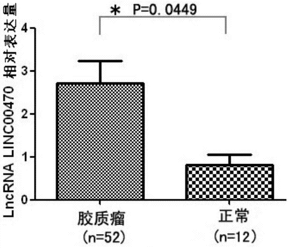 Application method of long non-coding RNA LINC00470 derived from serum exosomes