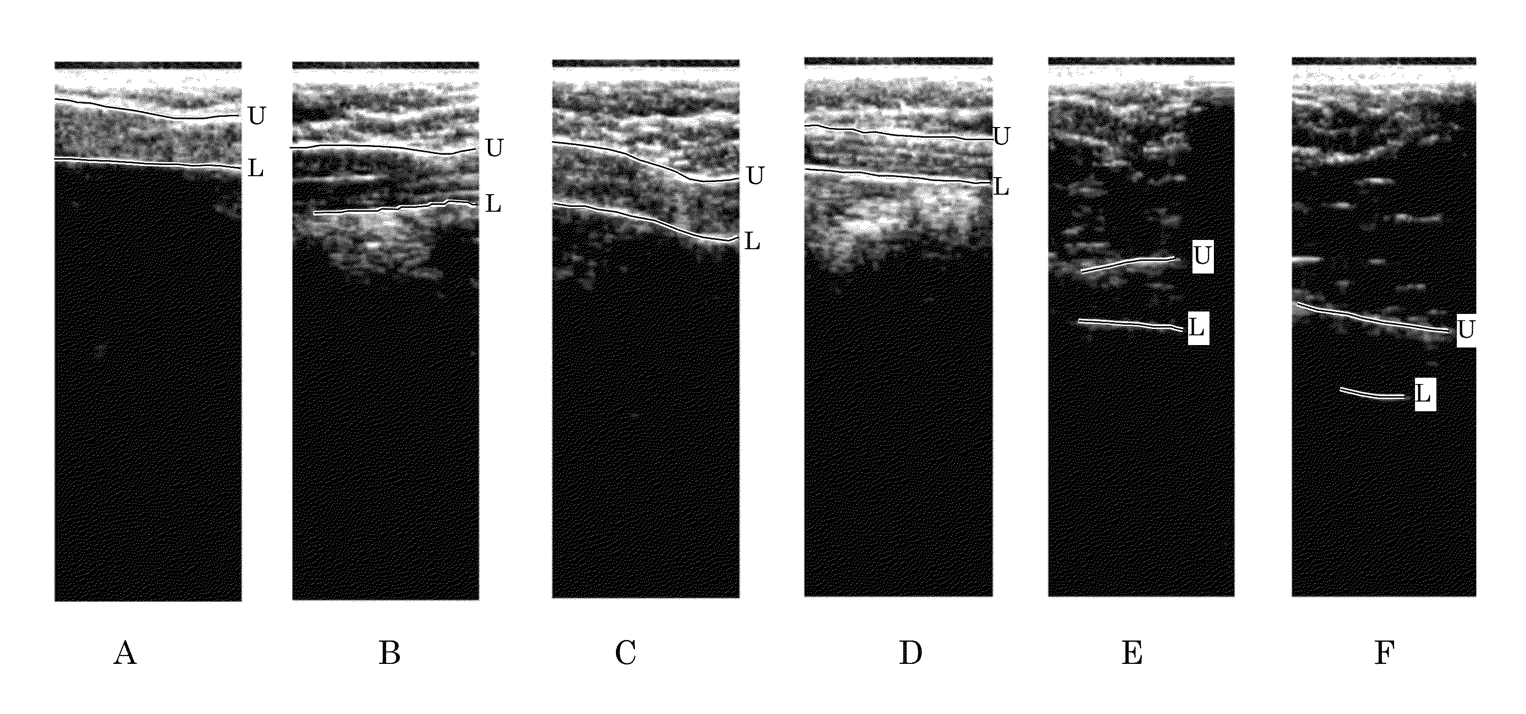 Orientation-aware average intensity histogram to indicate object boundary depth in ultrasound images