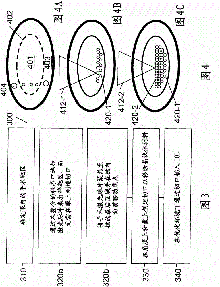Method and device for integrating cataract surgery with glaucoma or astigmatism surgery