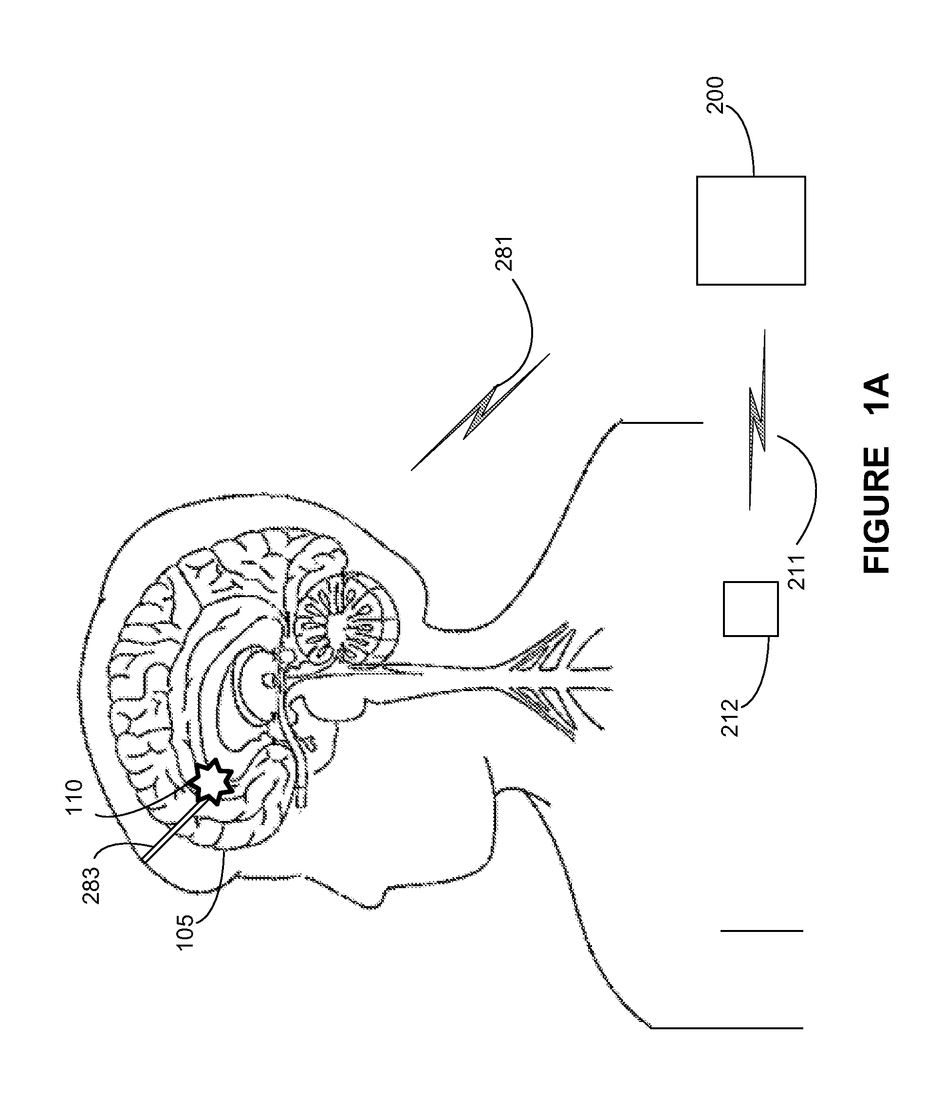 System and apparatus for increasing regularity and/or phase-locking of neuronal activity relating to an epileptic event