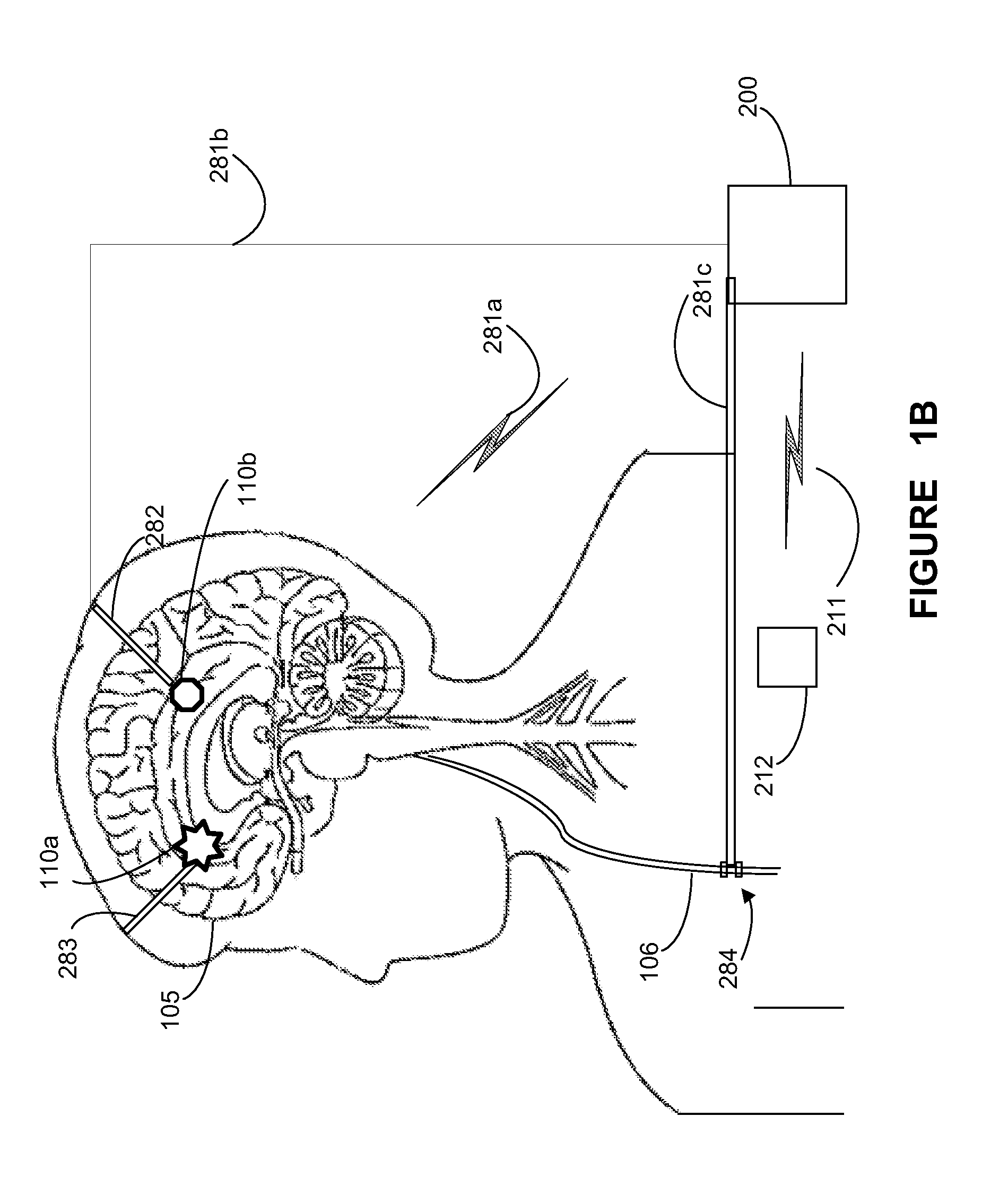System and apparatus for increasing regularity and/or phase-locking of neuronal activity relating to an epileptic event