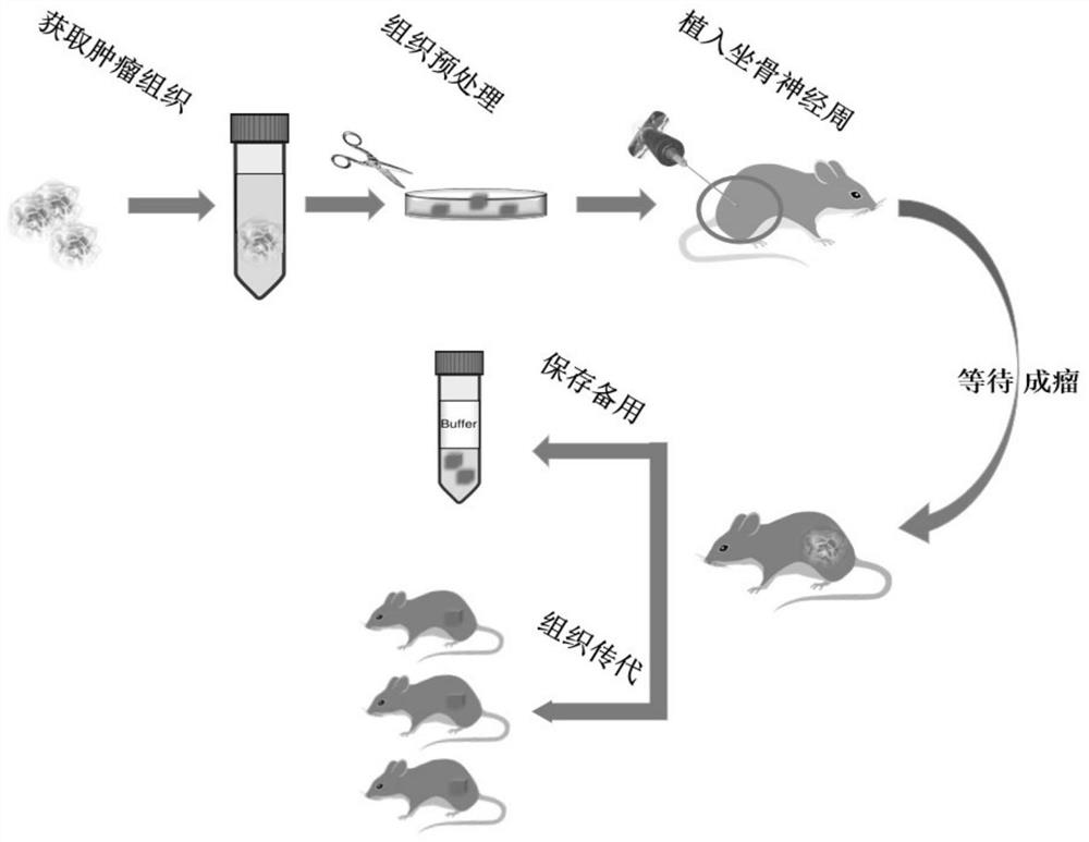 Building method and application of PDX model for perineural invasion of slivary adenoid cystic carcinoma