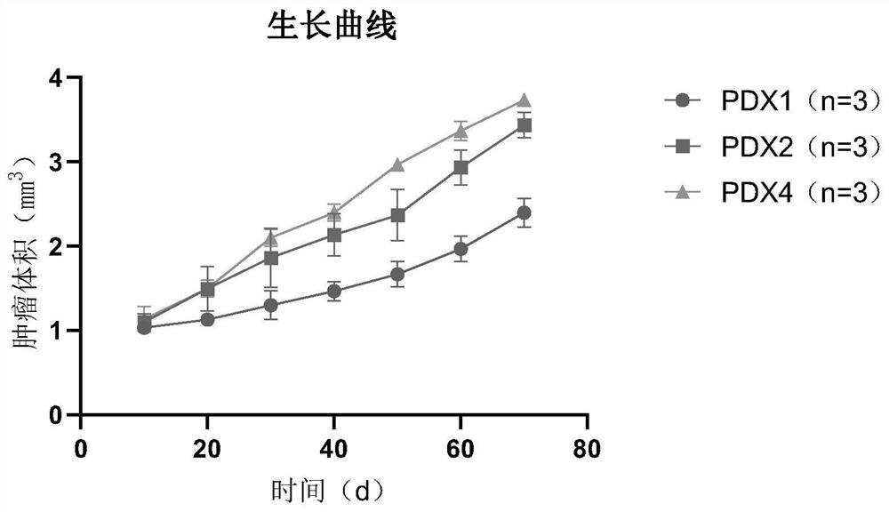 Building method and application of PDX model for perineural invasion of slivary adenoid cystic carcinoma