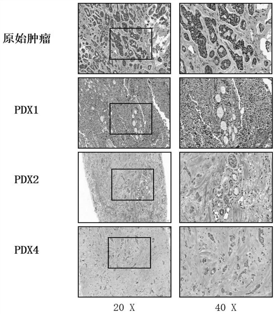 Building method and application of PDX model for perineural invasion of slivary adenoid cystic carcinoma