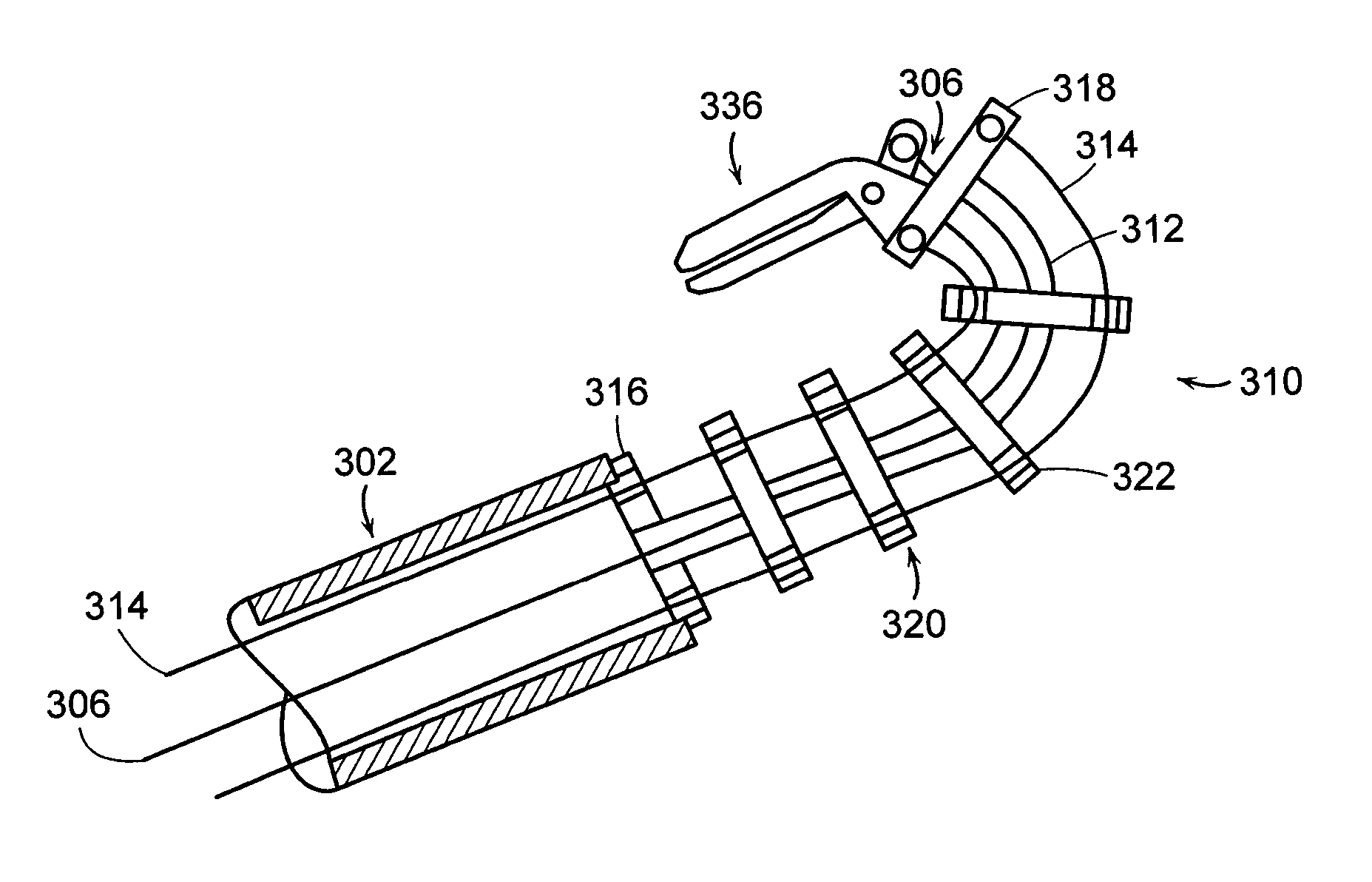 Devices, systems and methods for minimally invasive surgery of the throat and other portions of mammalian body
