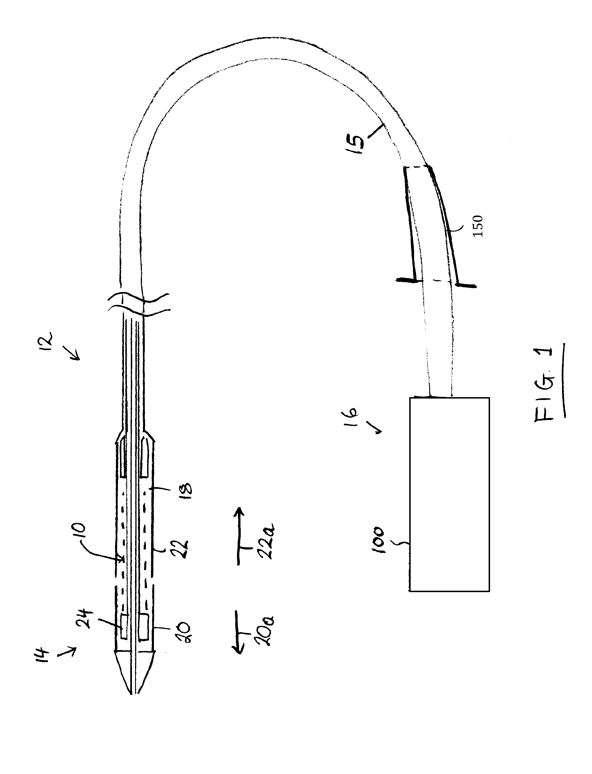 Stent-valve, delivery apparatus and method of use