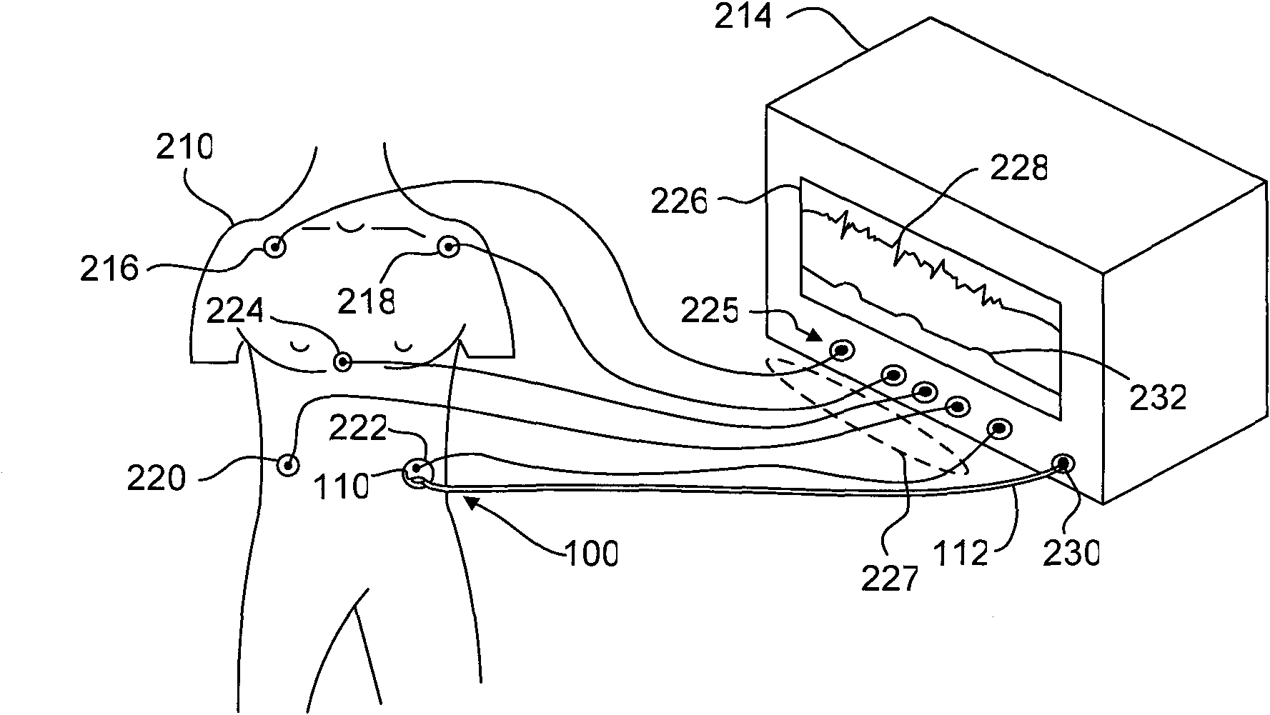 Method and system to measure ecg and respiration