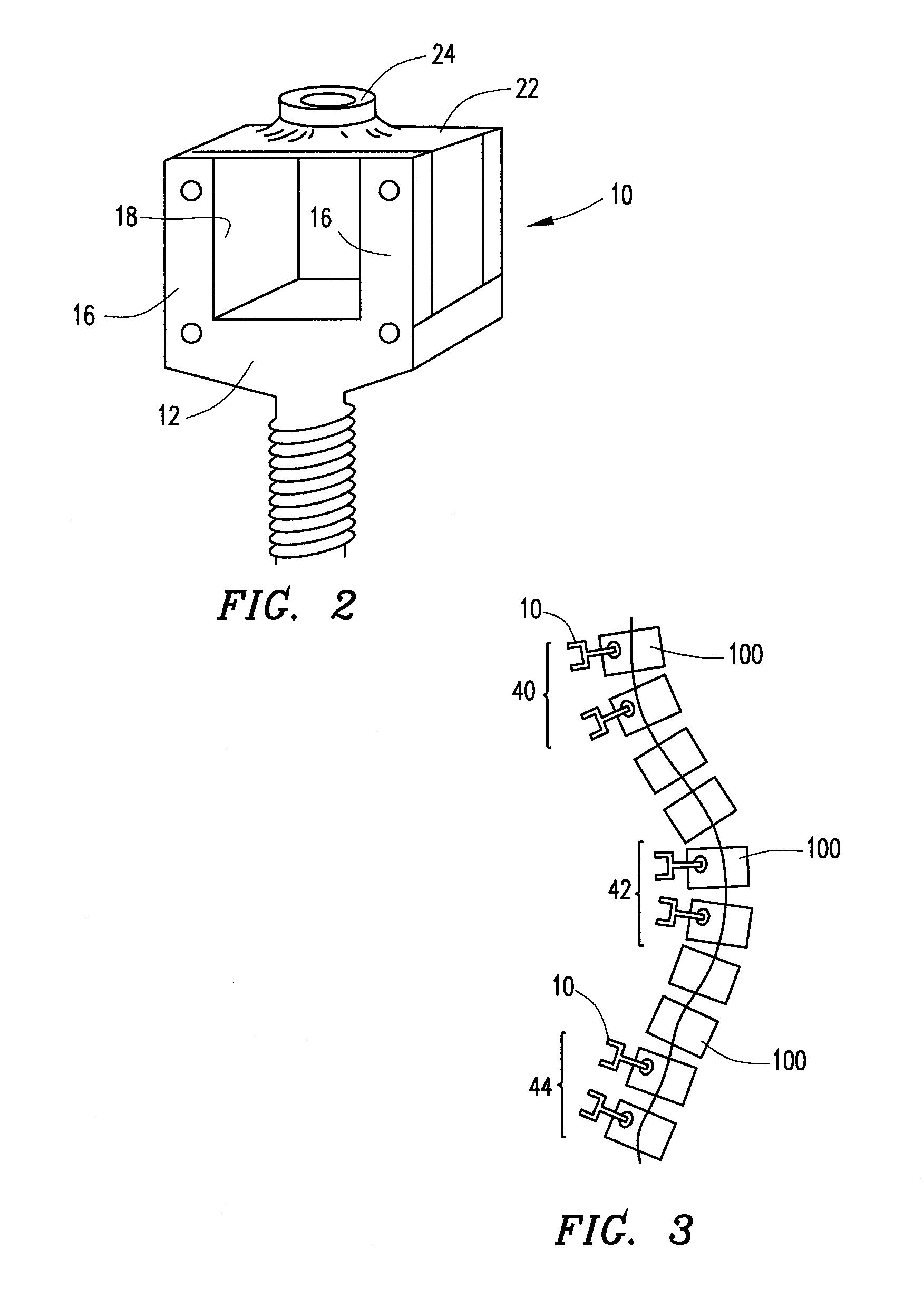System and method for aligning vertebrae in the amelioration of aberrant spinal column deviation conditions in patients requiring the accomodation of spinal column growth or elongation