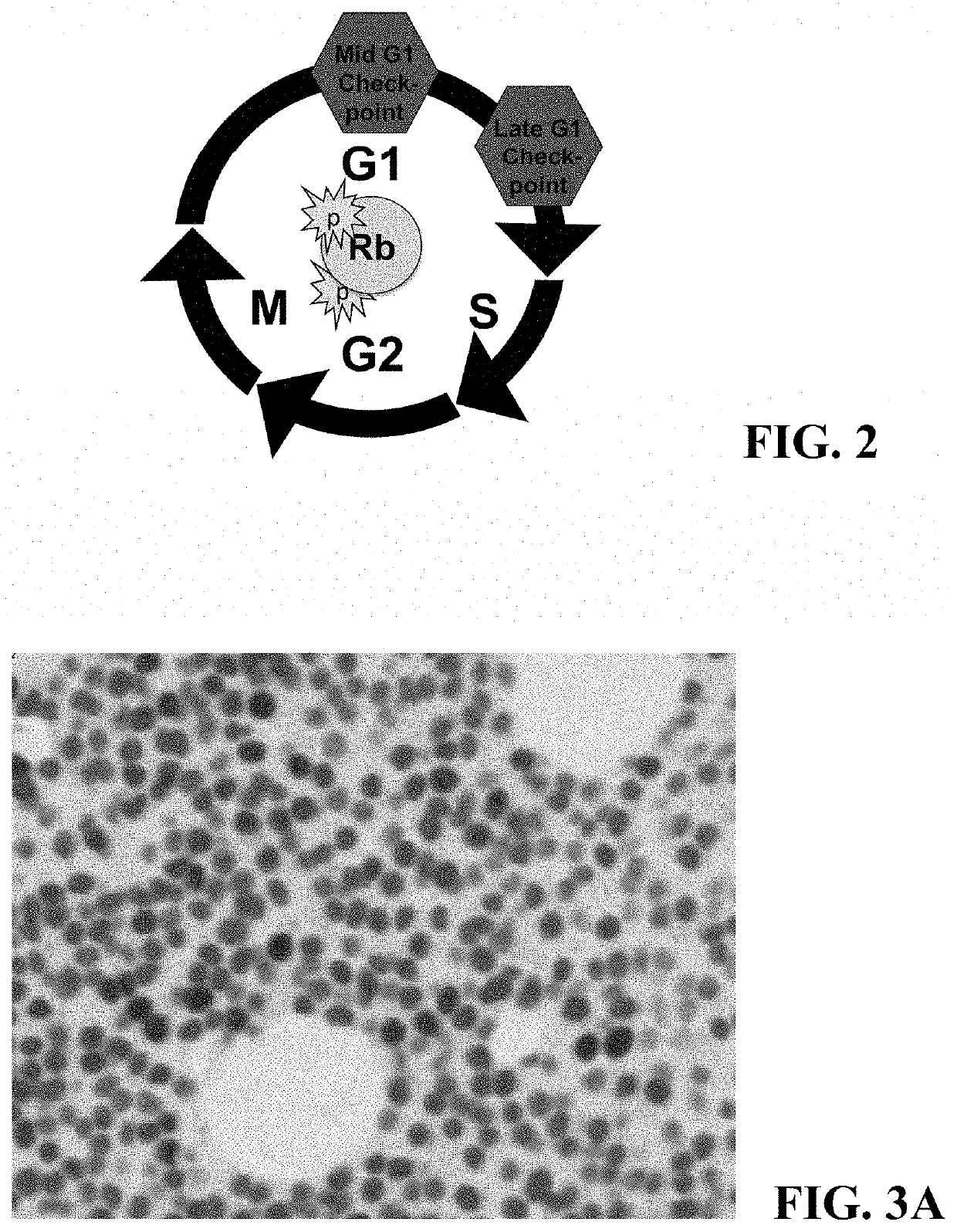 Method for double staining colocalized nuclear-markers in histological lymphoid or bone marrow tissue sample