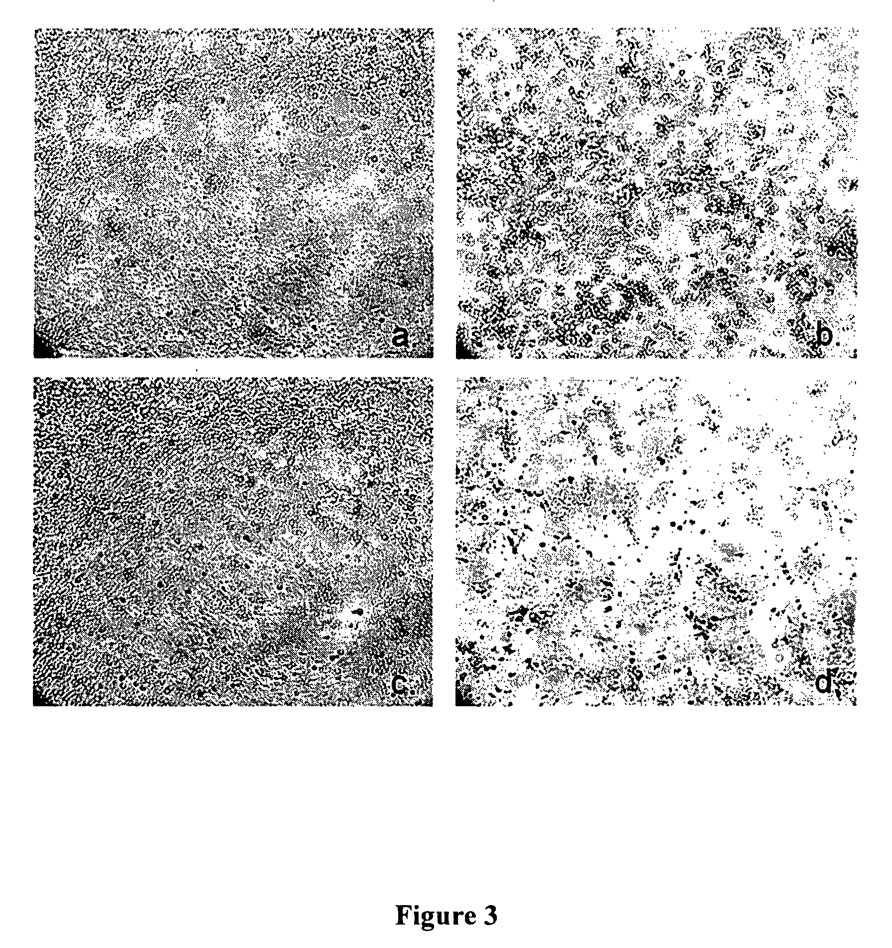 Clostridial toxin NetB