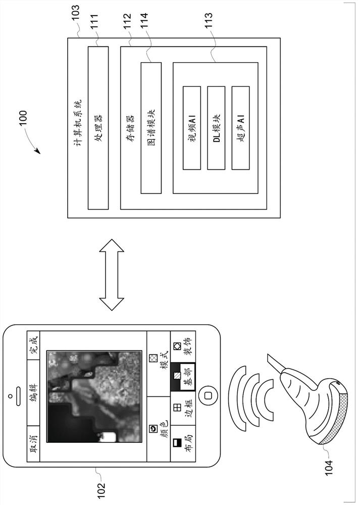 Guided lung coverage and automatic detection using ultrasound device