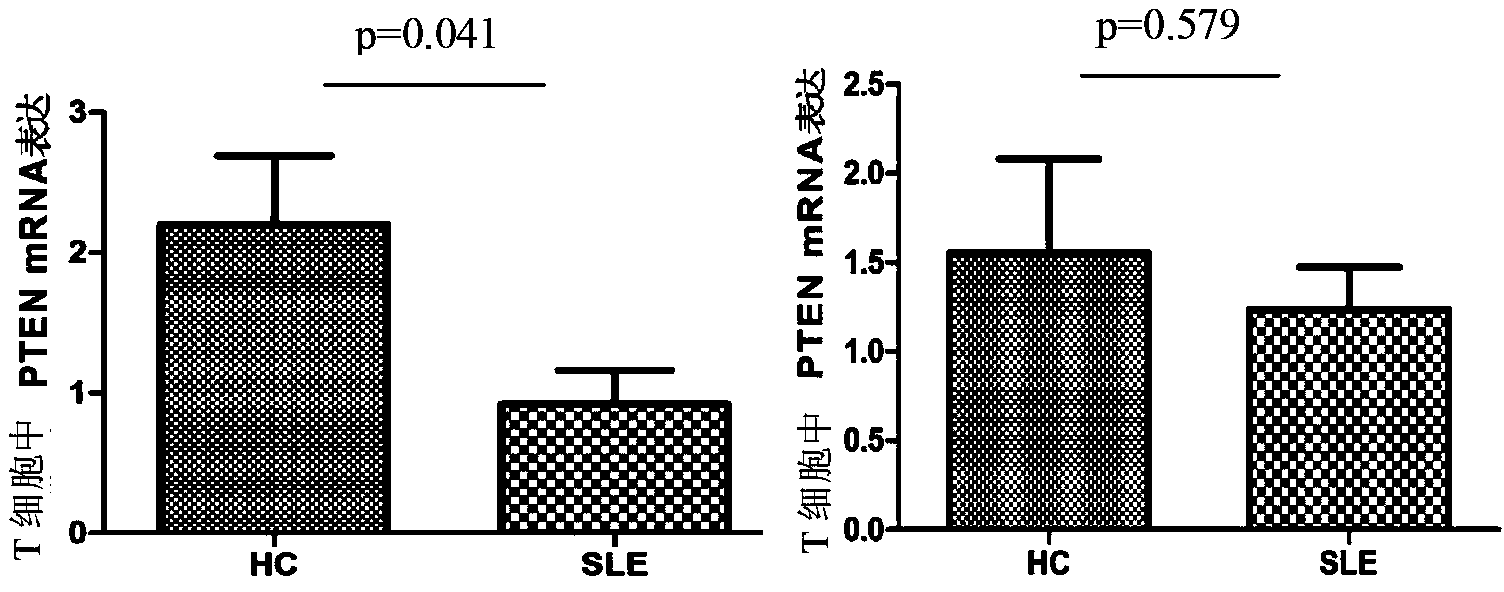 Application of miR-7 expression inhibitor in preparing medicines used for treating systemic lupus erythematosus