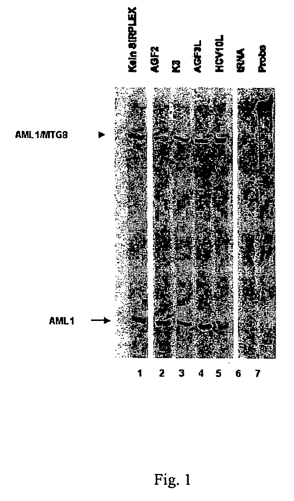 Double-stranded RNA (dsRNA) and method of use for inhibiting expression of a fusion gene