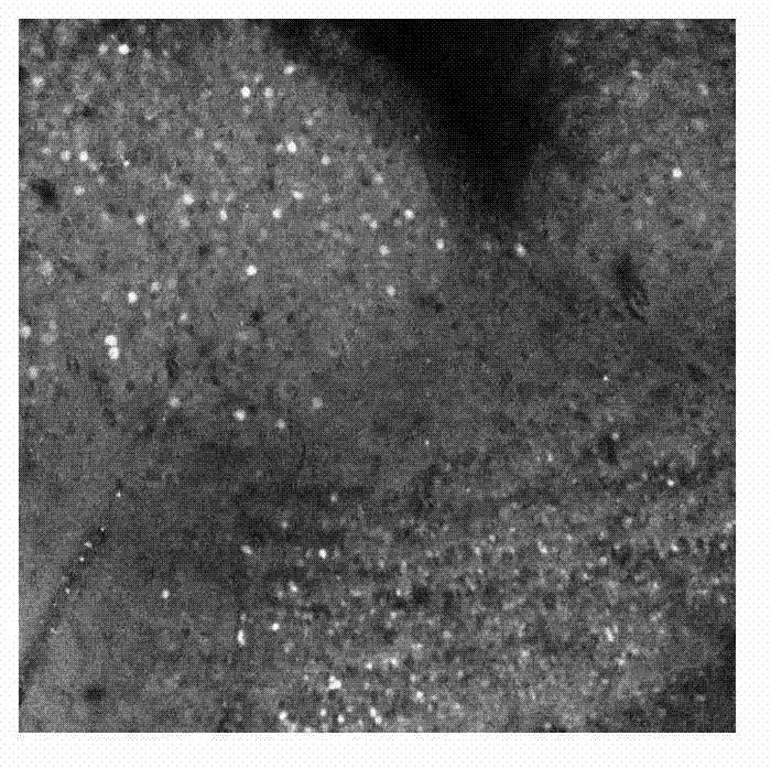 Rat brain section microscopic image segmentation method based on markov random field theory