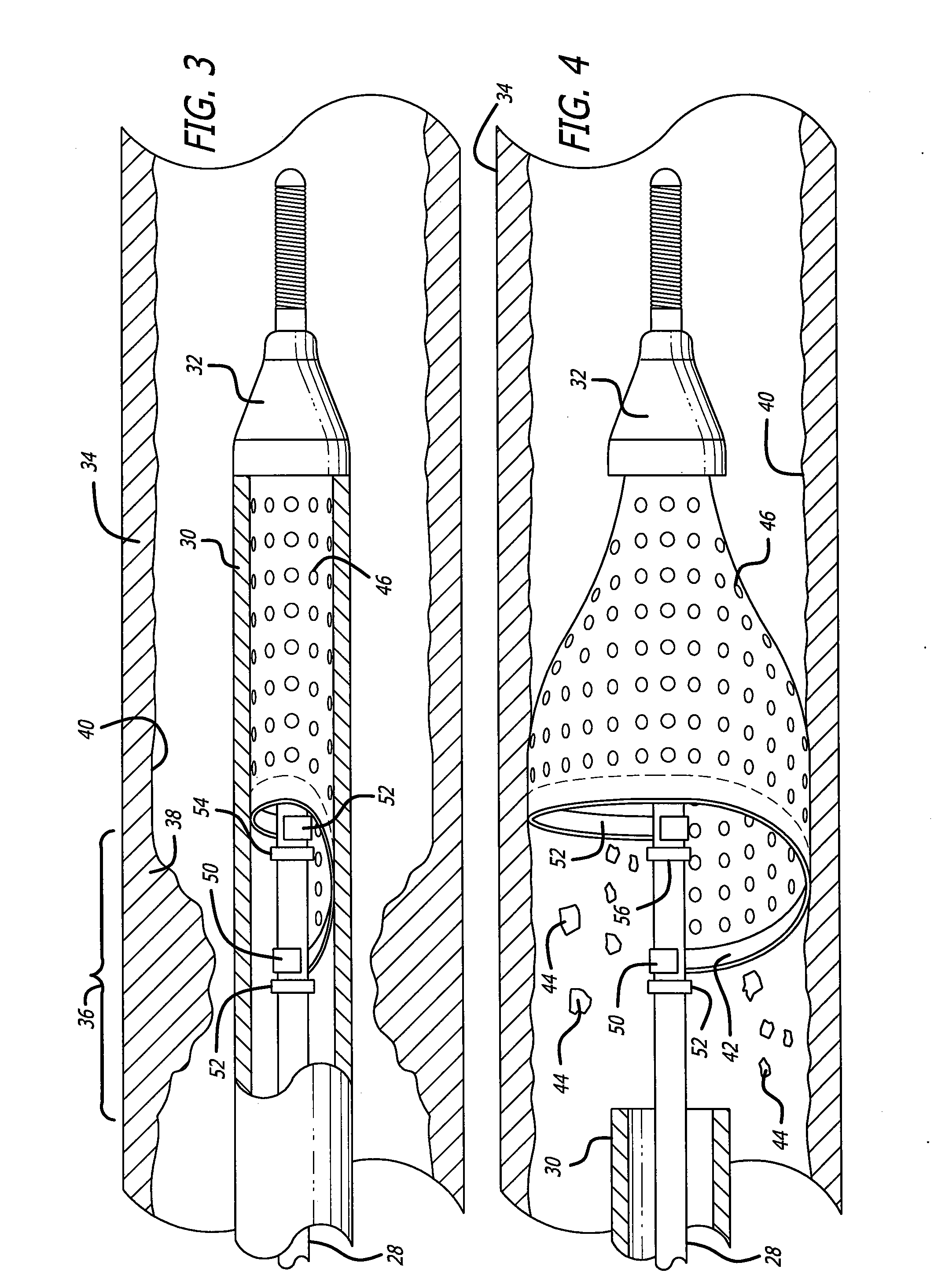 Single-wire expandable cages for embolic filtering devices