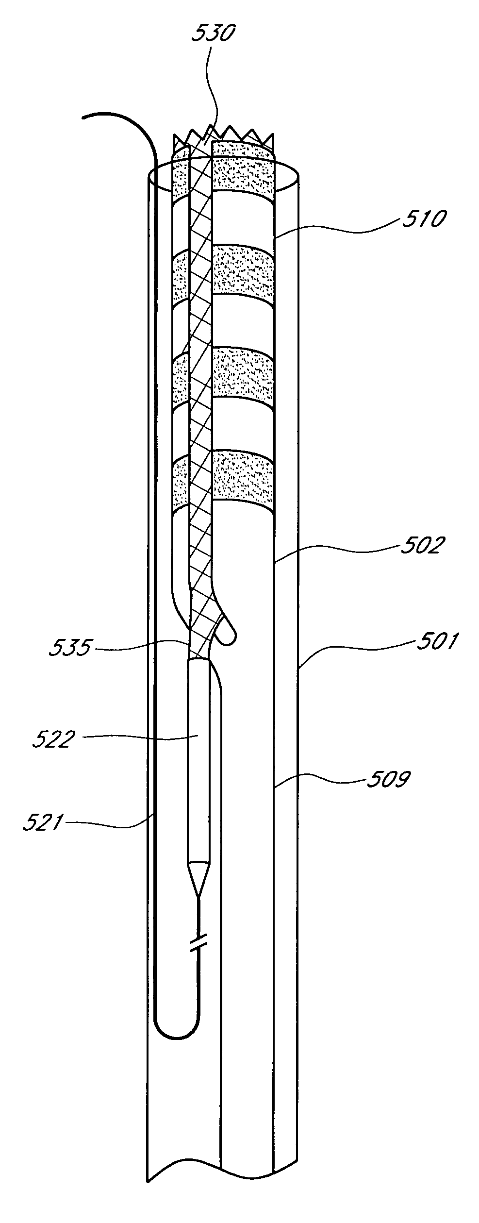 Vascular graft and deployment system