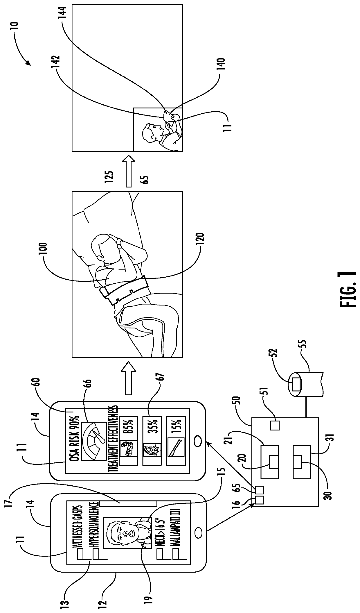 Method and system for diagnosis and prediction of treatment effectiveness for sleep apnea