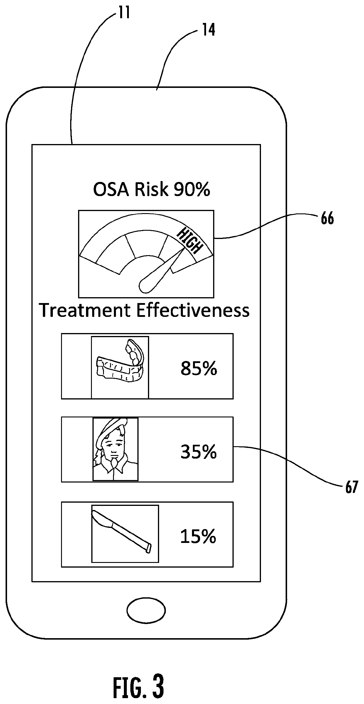 Method and system for diagnosis and prediction of treatment effectiveness for sleep apnea