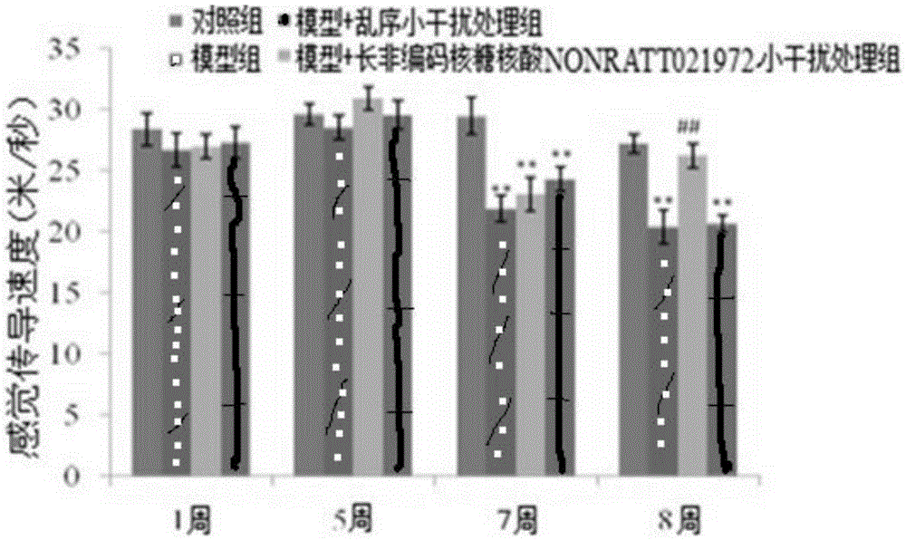 Use of long non-coding ribonucleic acid NONRATT021972 small interfering RNA in preparation of drug for treating diabetes mellitus with neuropathic pain