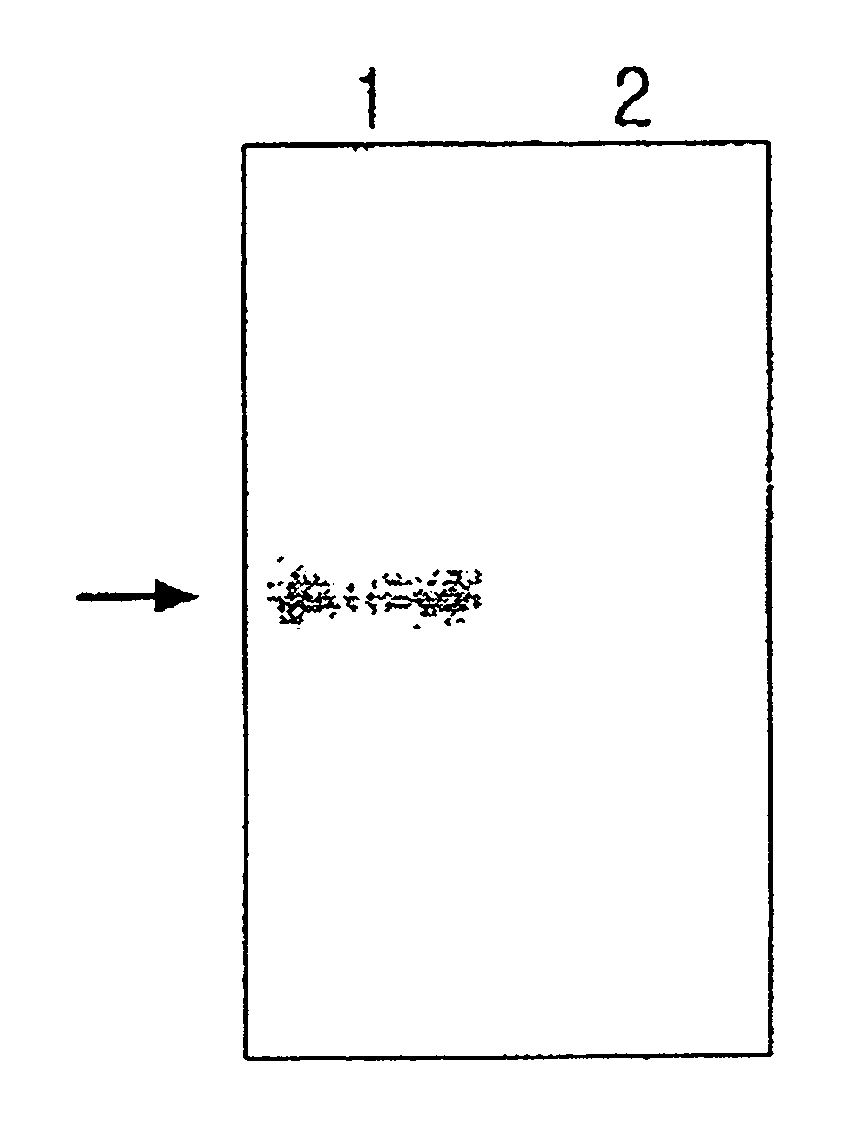 Kit and method of screening wilson's disease