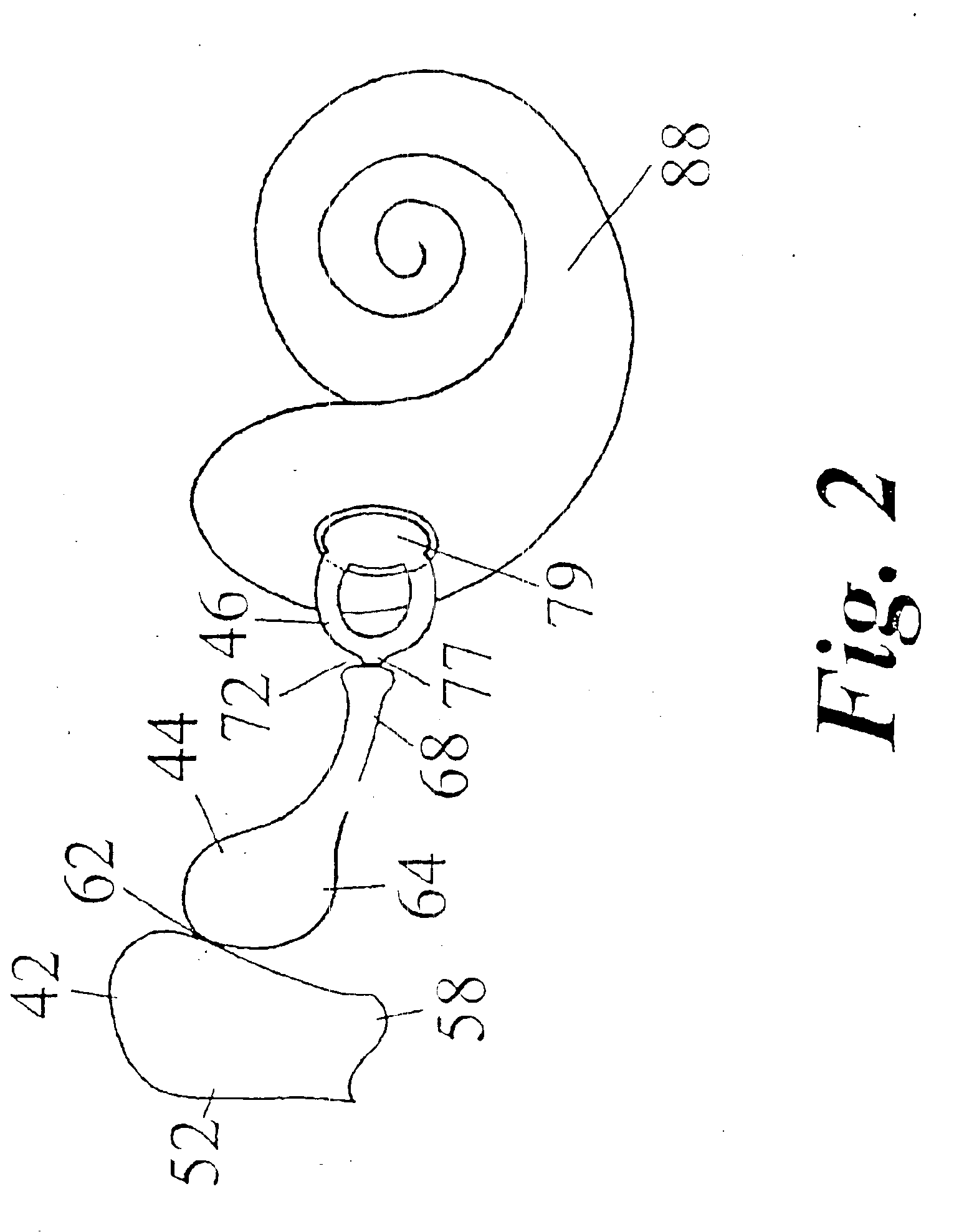 Method for creating a coupling between a device and an ear structure in an implantable hearing assistance device