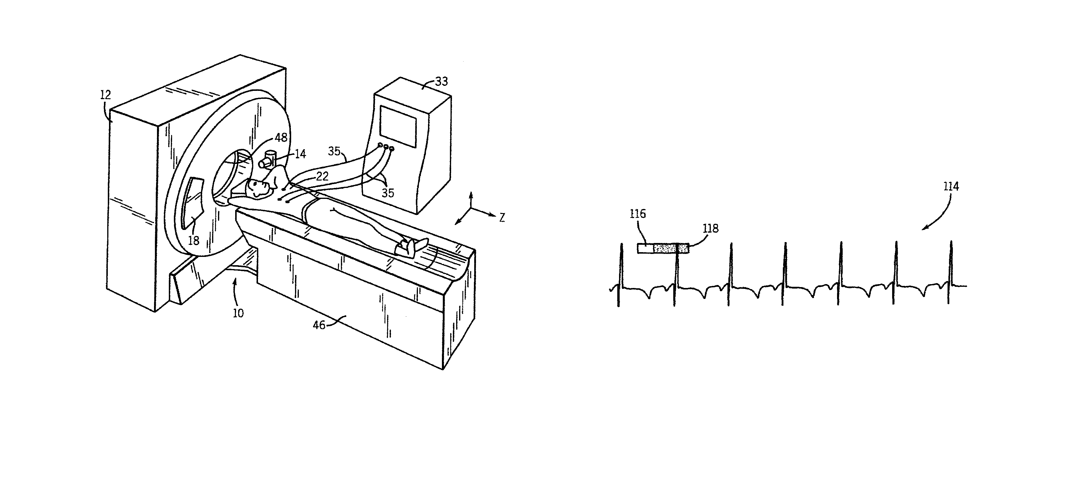 Step-and-shoot cardiac CT imaging