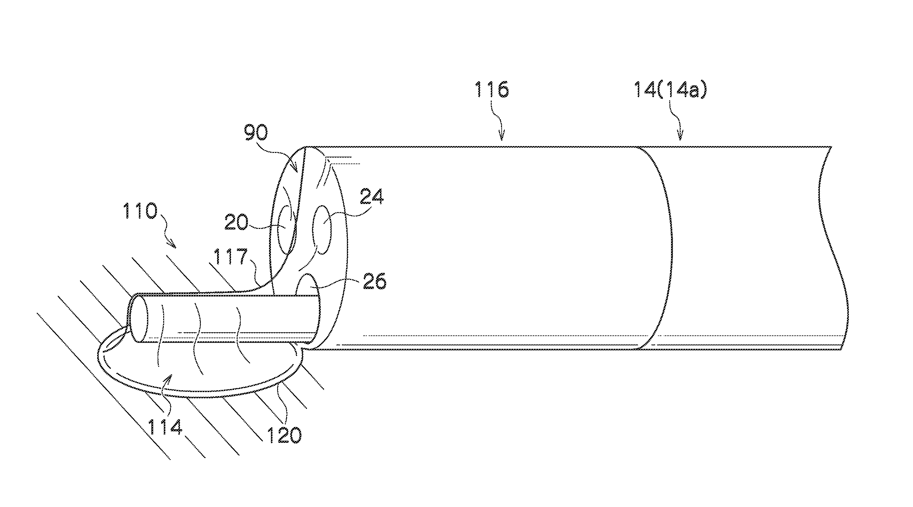 Endoscope hood