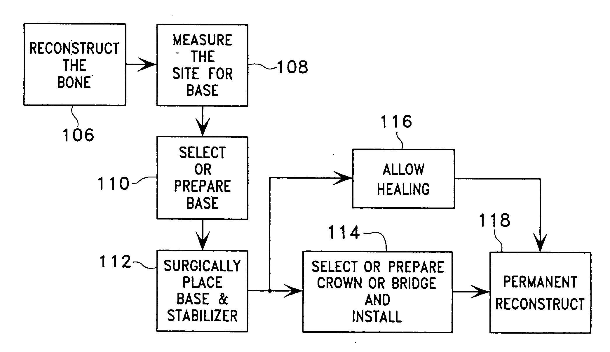 Method and apparatus for dental implants