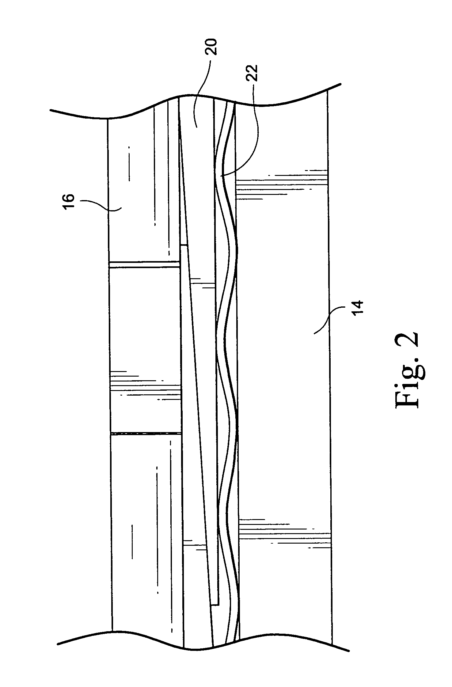 Apparatus and methods for removing wedges of a stator core of an electrical machine
