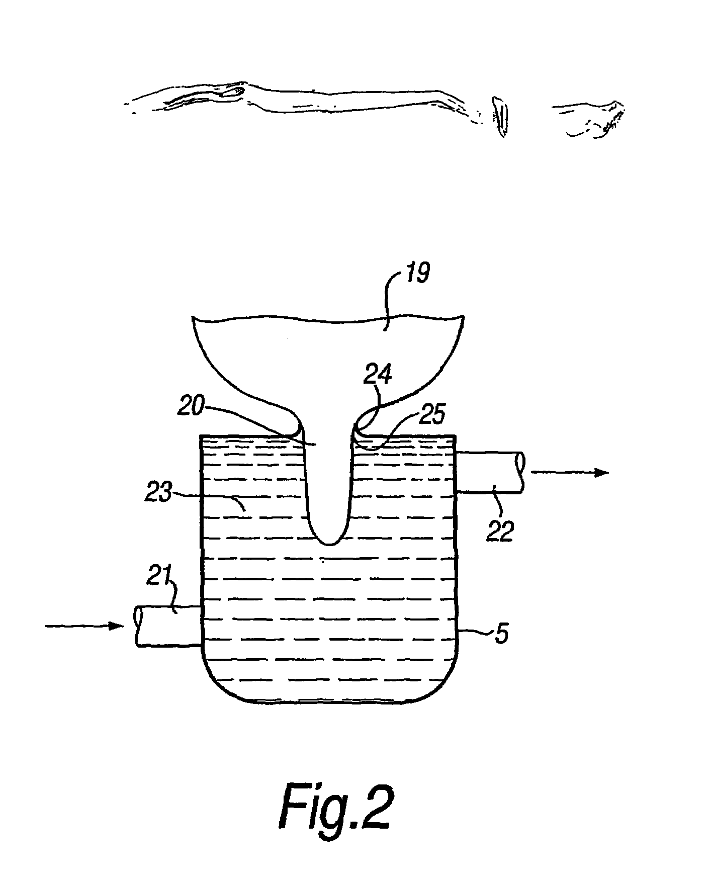 Method and apparatus for treating the teats of an animal
