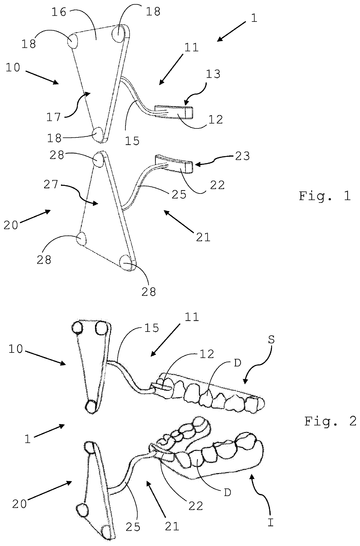 An apparatus for tracking and recording the movements of a person's jaw and the relative method