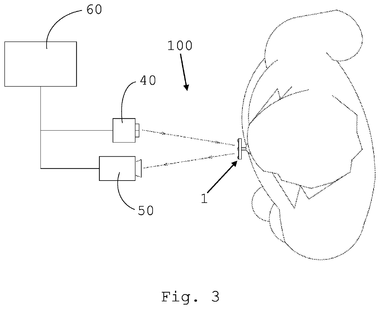 An apparatus for tracking and recording the movements of a person's jaw and the relative method