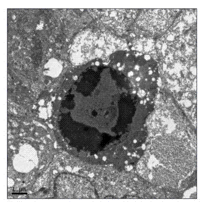 Composite magnetic nanoparticles for targeted therapy of liver cancer and preparation method thereof