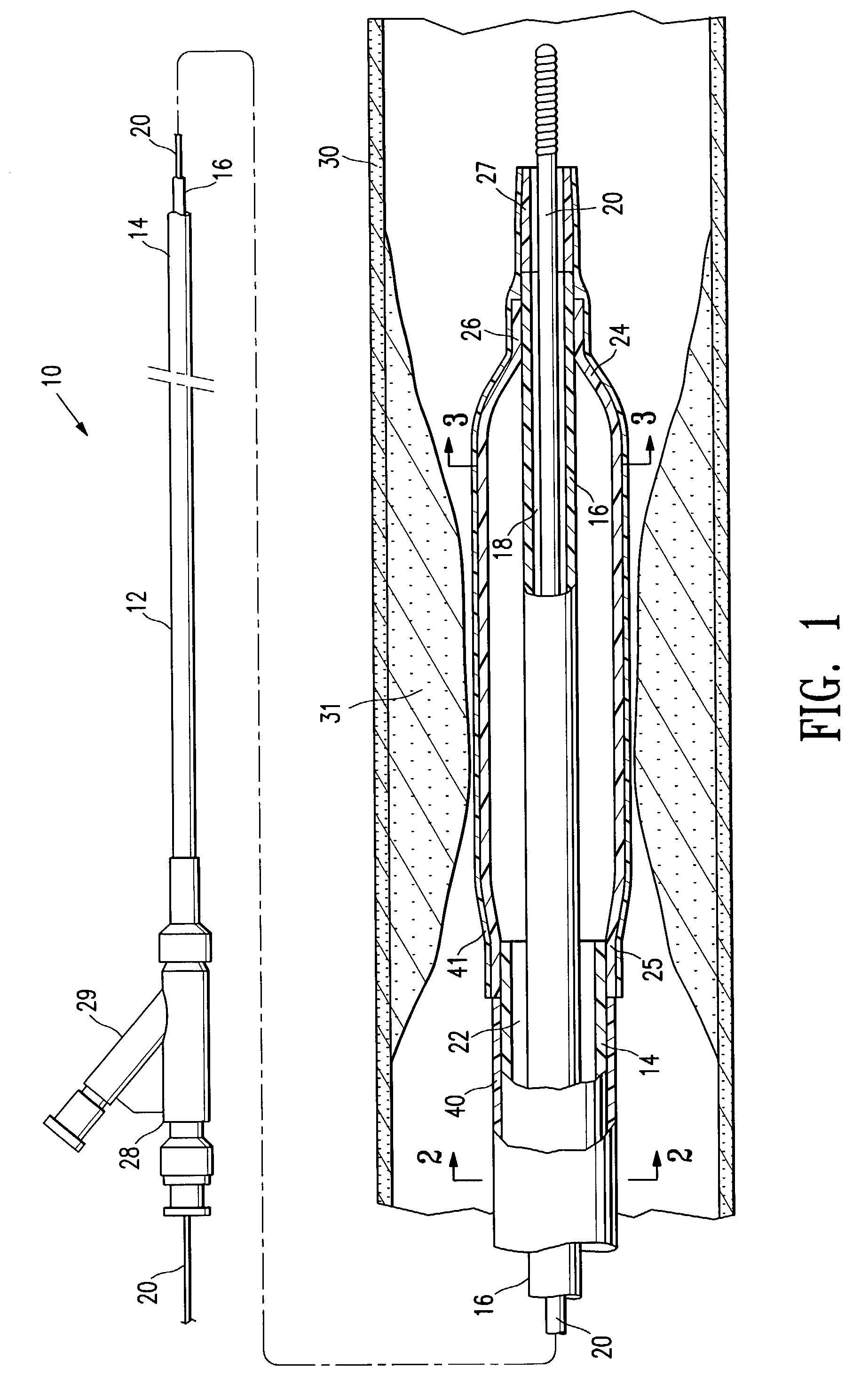 Reduced slippage balloon catheter and method of using same