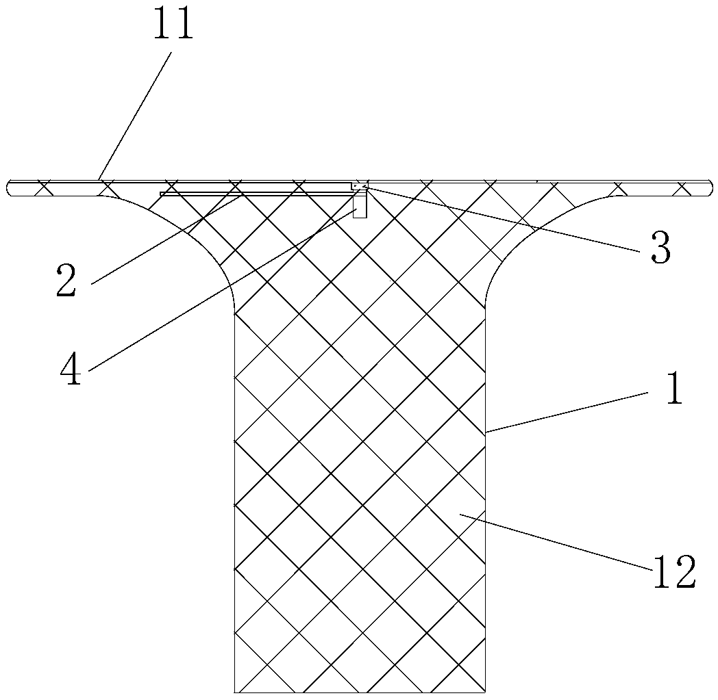 A blood flow restrictor for interventional surgery of congenital heart disease