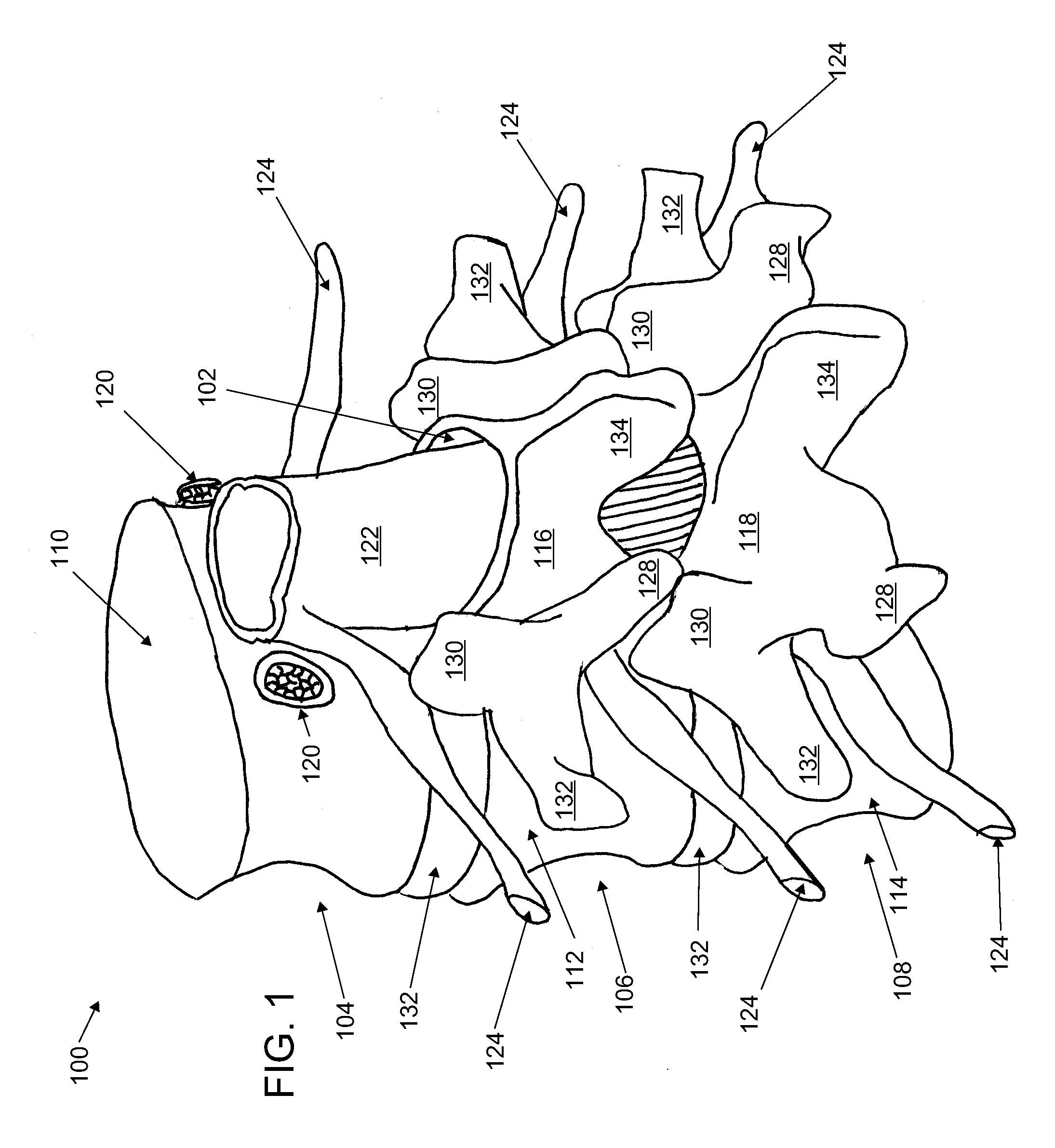 Systems and methods for cable-based tissue removal