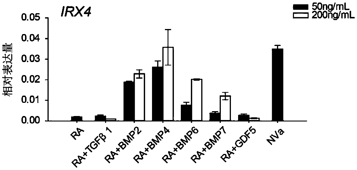 A method for in vitro differentiation of induced pluripotent stem cells into ventricular myocytes