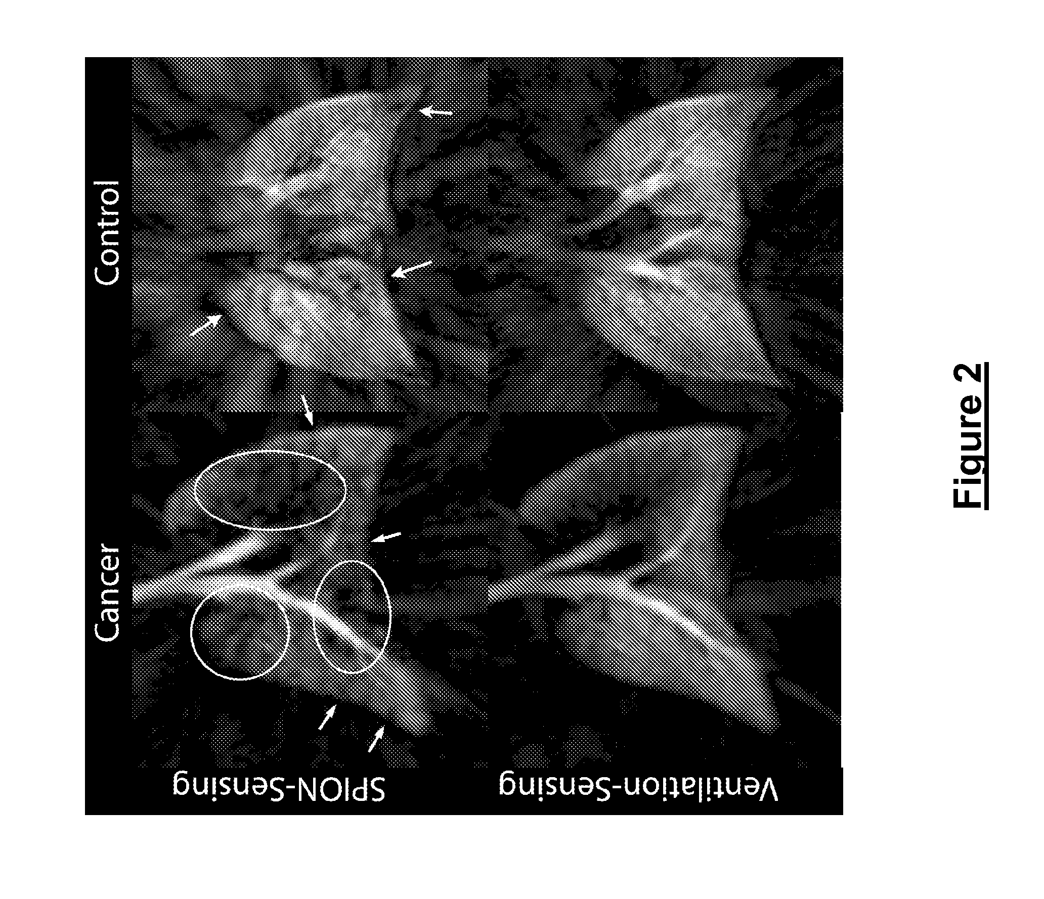 Methods and compositions for molecular imaging