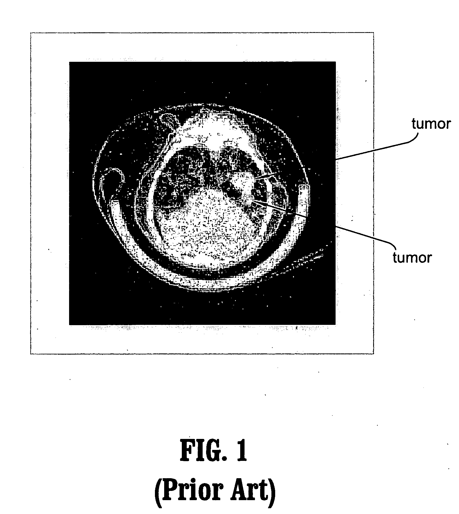 Methods and systems for 3D object detection using learning