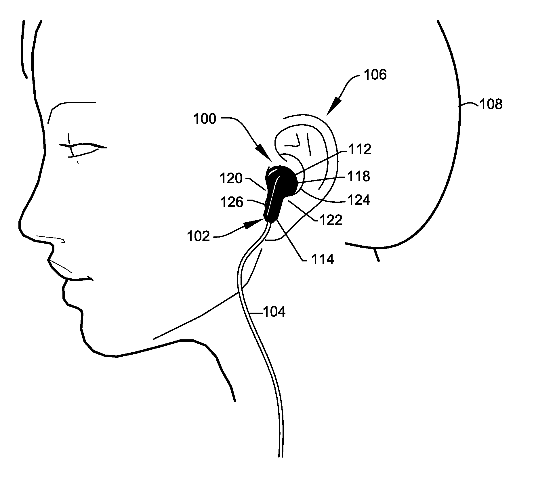 Earbud Protection Systems