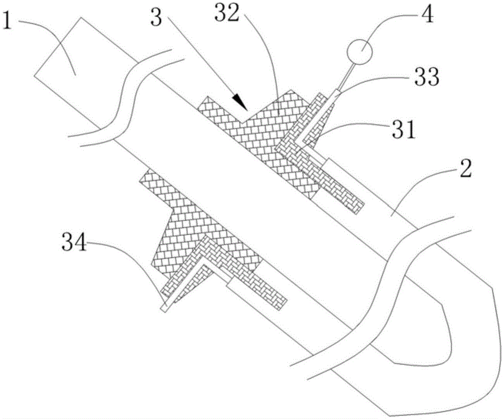 Cross-shaped double-jacketed drainage tube