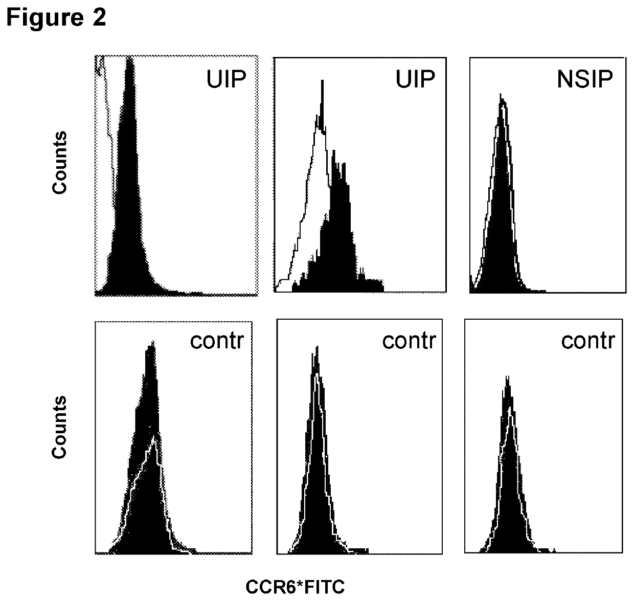 Blockade of CCL18 signaling via CCR6 as a therapeutic option in treating interstitial lung disease