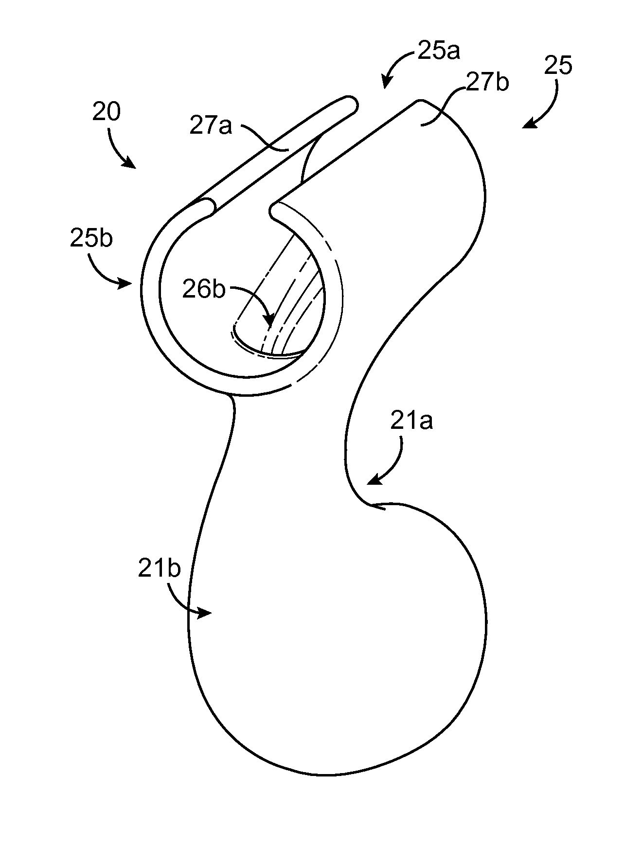 Extravascular devices supporting an arteriovenous fistula