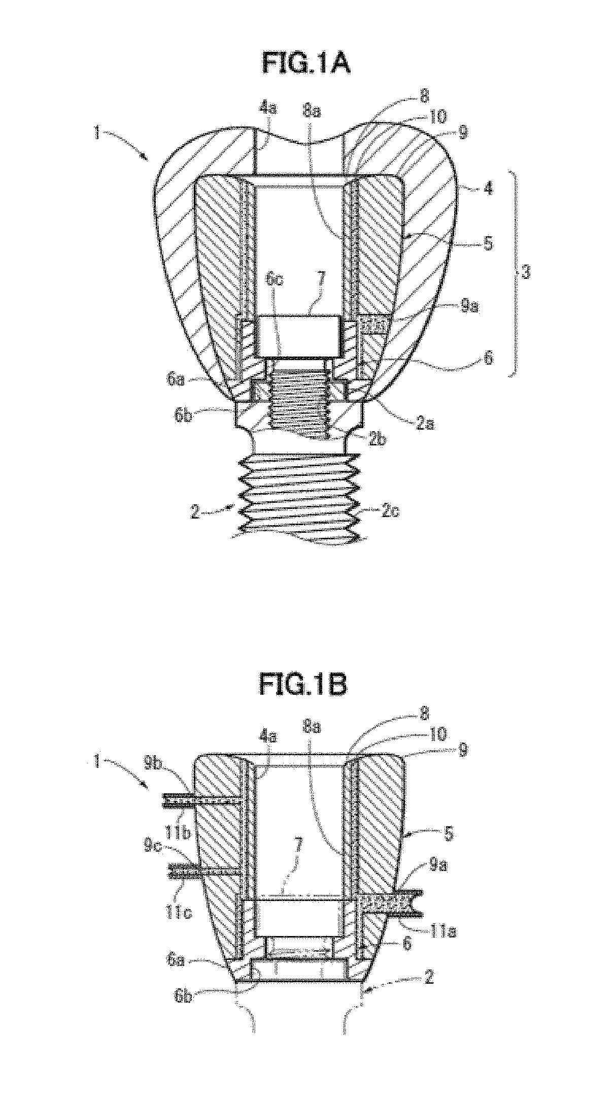 Implant superstructure