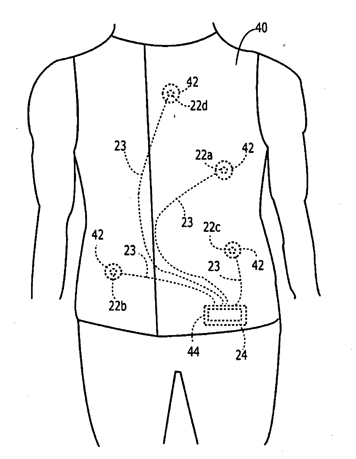 Method and System for Monitoring Gastrointestinal Function and Physiological Characteristics