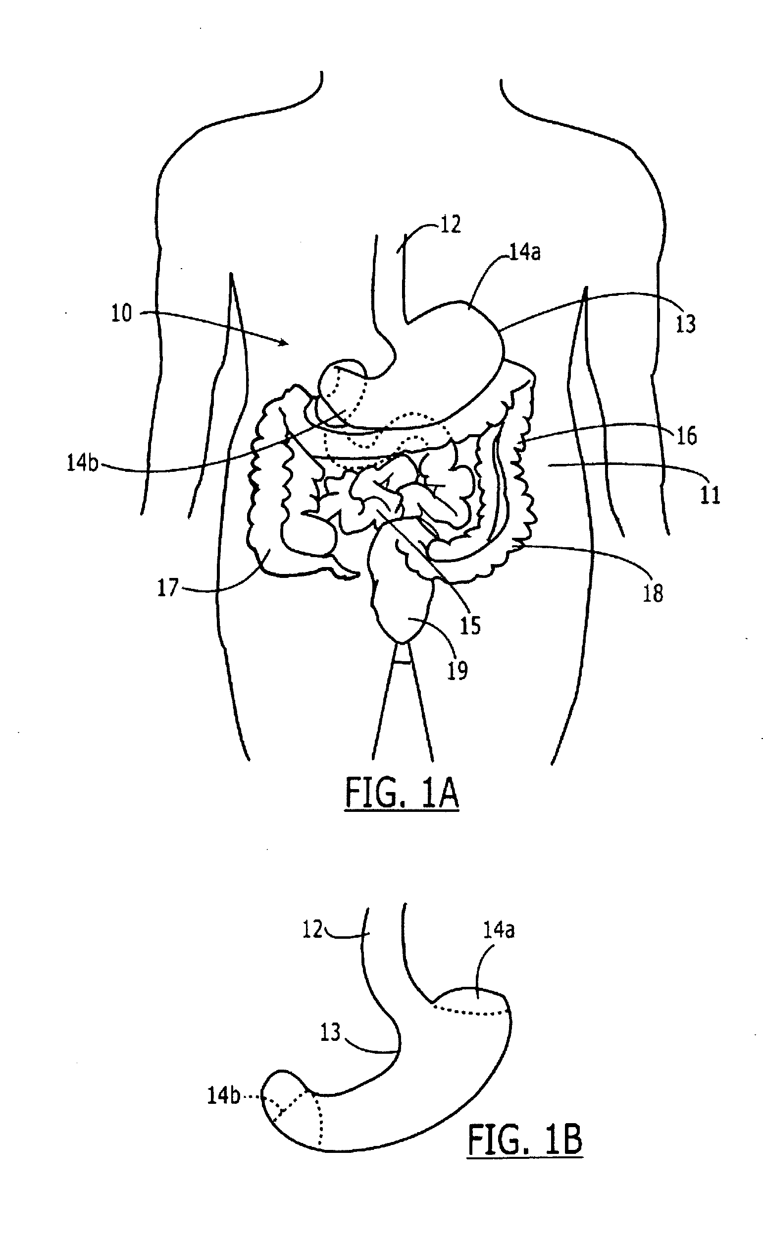 Method and System for Monitoring Gastrointestinal Function and Physiological Characteristics
