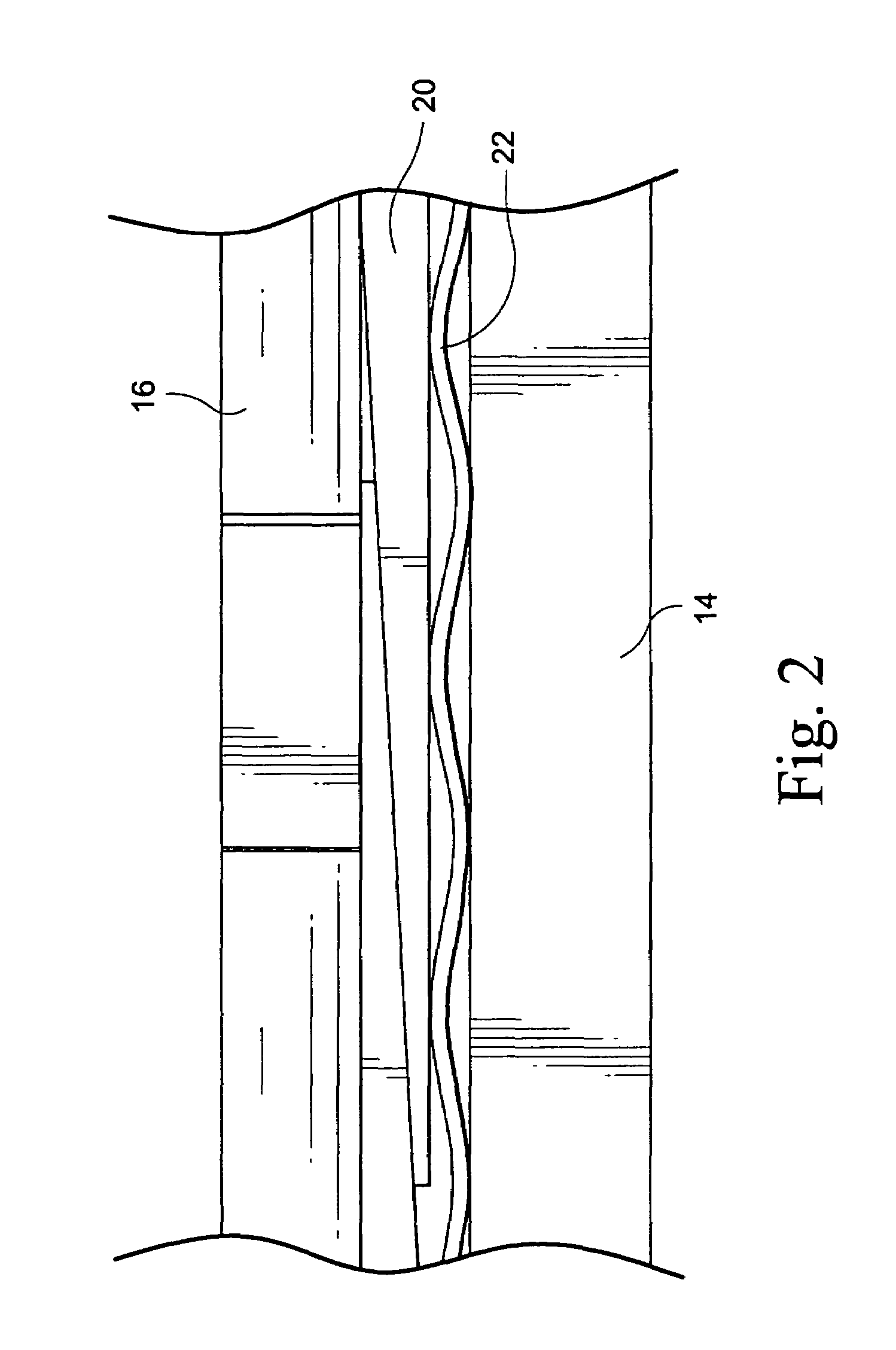 Apparatus for cutting and removing wedges of a stator core of an electrical machine
